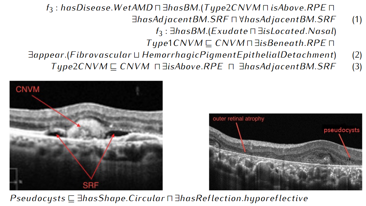 Using the AMD ontology to classify images